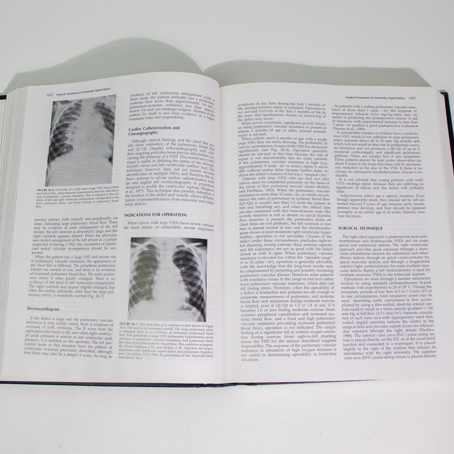 Surgery of the Chest, Sixth Edition, Volume II