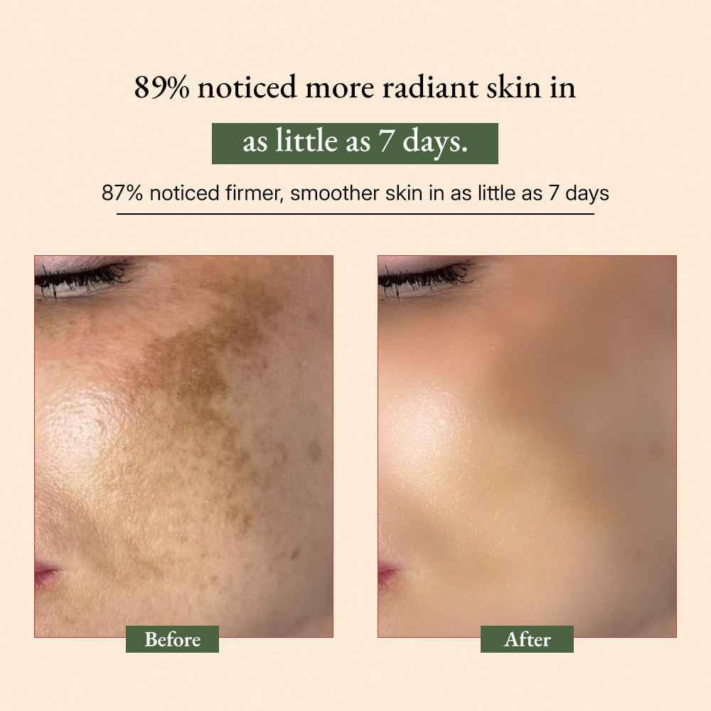 Anti-aging SPA Kit: An Ultimate Hydration Duo (Tridoshic)