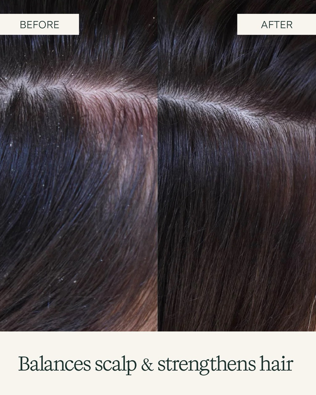 The Scalp Care bundle