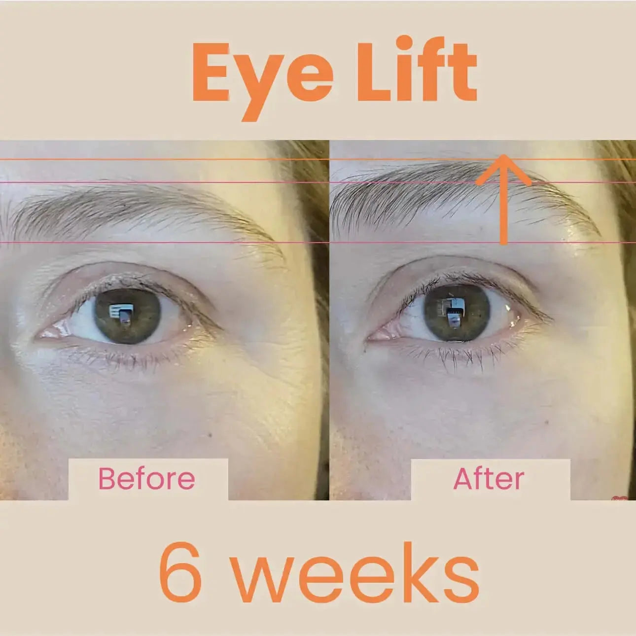 EvenSkyn® Venus: Advanced Eyelid Anti-Aging Device