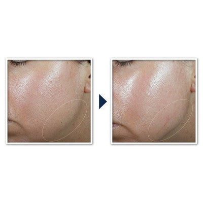 RoC Derm Correxion Contour Cream for Face and Neck 1.7oz - Missing Box