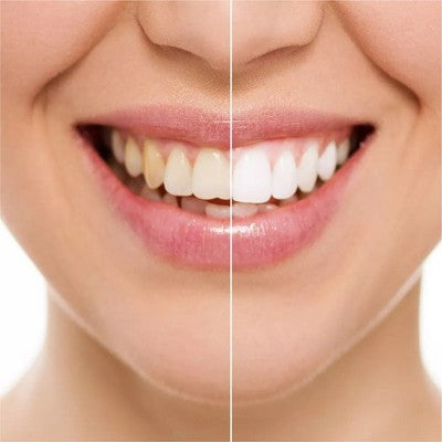 Rembrandt Deeply White + Peroxide Whitening Toothpaste with Fluoride 3.5oz/2pk - New