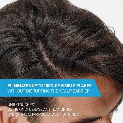CeraVe Anti-Dandruff Scalp Care Shampoo 12 fl oz - Imperfect Container