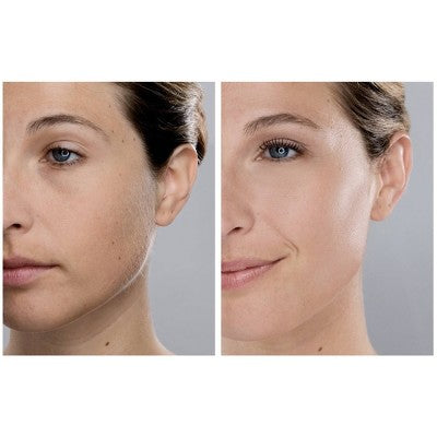 Spa Sciences SIMA Dermaplaning Replacement Safety Tips 6ct - New