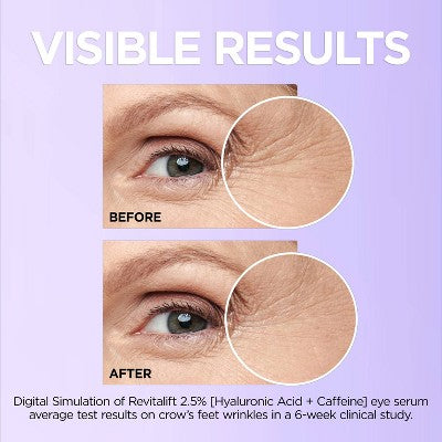 L'Oreal Paris Revitalift Derm Intensives Hyaluronic Acid+Caffeine 0.67 fl oz - Missing Box
