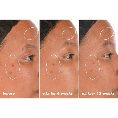 e.l.f. SKIN Bright Icon Vitamin C + E + Ferulic Face Serum 1 fl oz - Imperfect Box