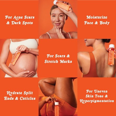 Bio-Oil Body Oil and Scar Treatment with Vitamin E 6.7 fl oz - Imperfect Box