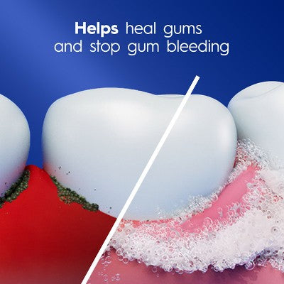 Crest Pro-Health Gum Detoxify Deep Clean Toothpaste 4.8oz/2pk - Imperfect Box