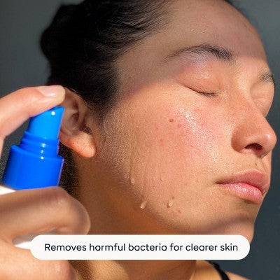 Magic Molecule Hypochlorous Acid Skin Spray 3.4oz/2ct - Imperfect Box