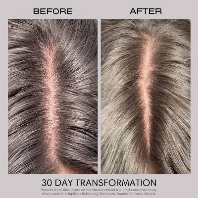 Jupiter Anti-Dandruff Restoring Scalp Serum 2.1 fl oz - New
