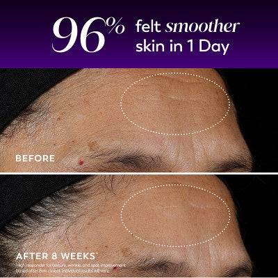 Olay Regenerist Anti-Aging Night Serum, Hydrating & Wrinkle Correcting Treatment 1 fl oz - Imperfect Box
