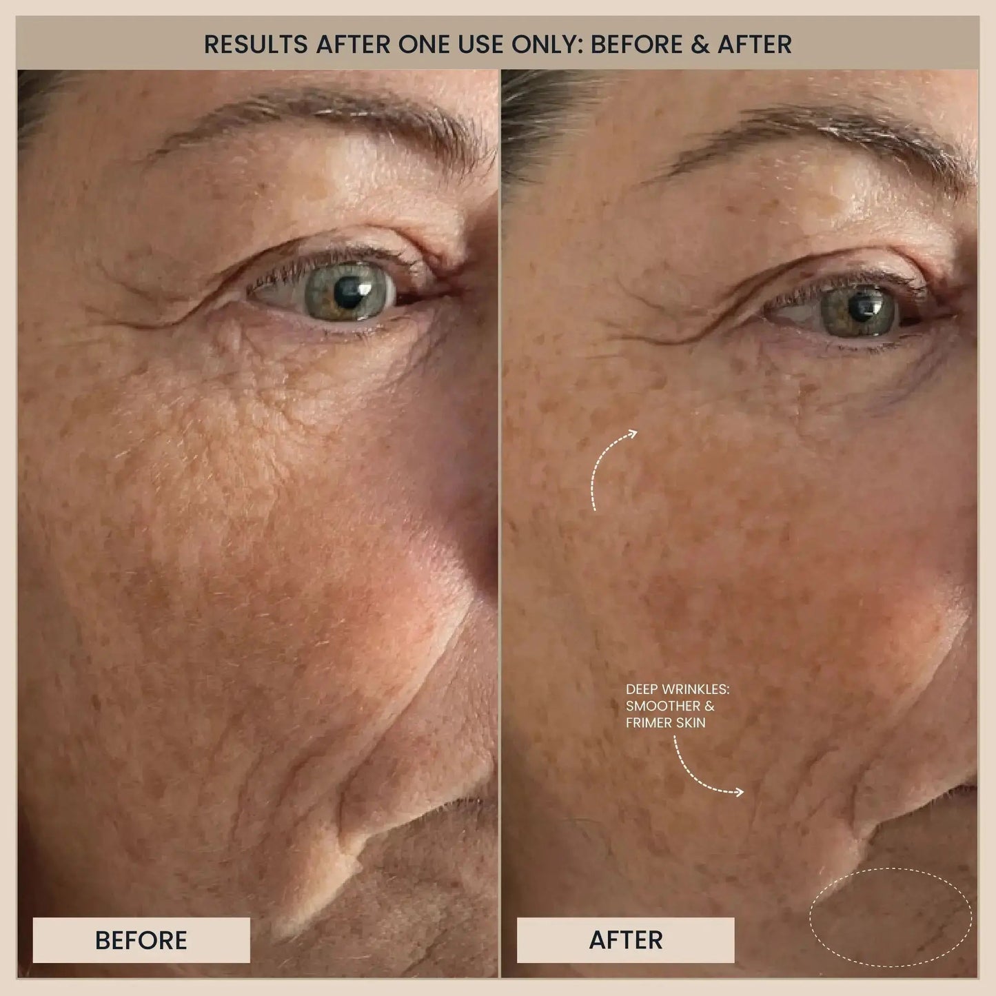 Lumo⁺ + Mirage + Venus: Complete Anti-Aging and Skin Rejuvenation Set