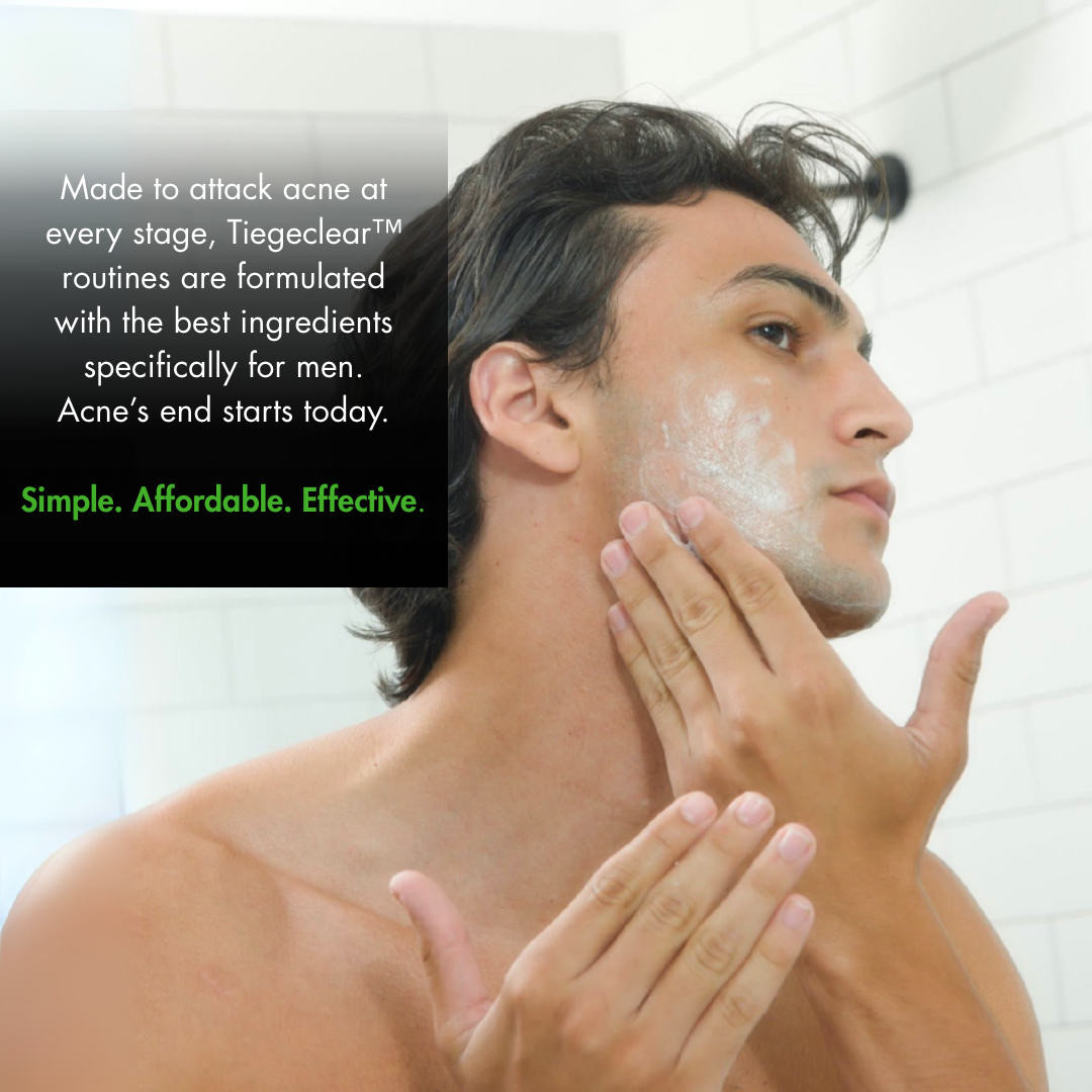 The TiegeClear® ACNE Essentials Routine for Men - Osadia Concept Store